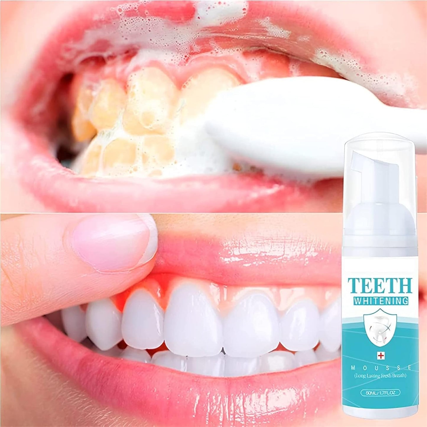 OralWhite™ | Ta bort tandsten, lugna tandköttet – vitare tänder, fräschare andedräkt