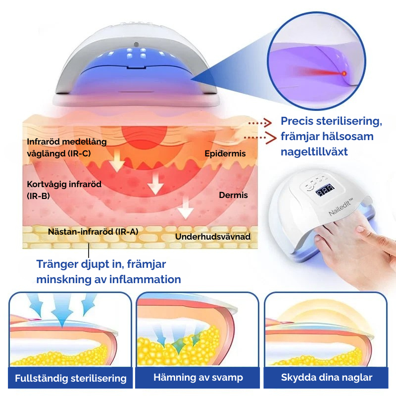 NailedIt™ | Apparat för laserbehandling av nagelsvamp