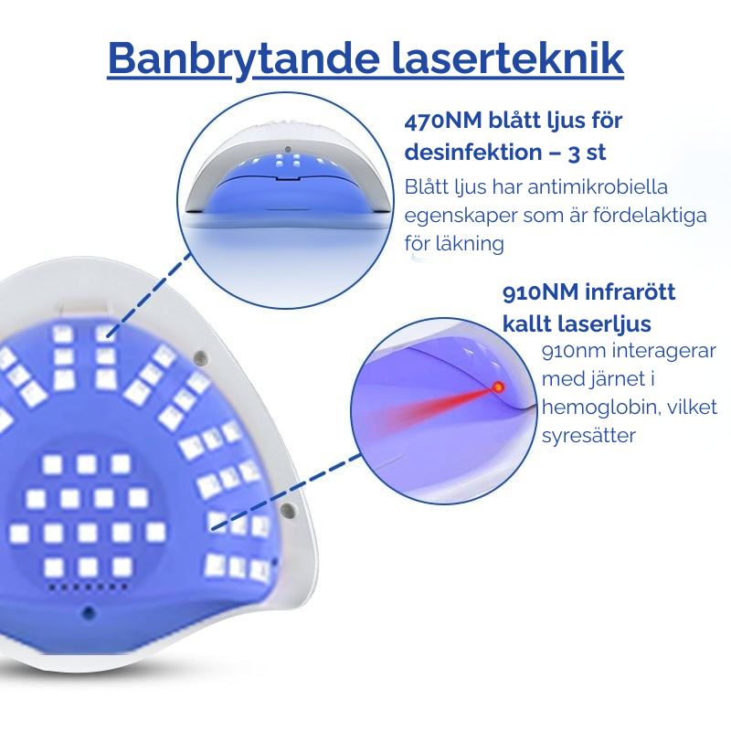 NailedIt™ | Apparat för laserbehandling av nagelsvamp