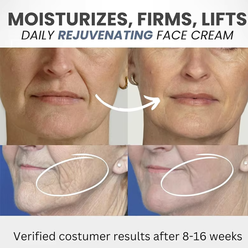 AgeDefy™ Retinol Cream | + FREE HydraGlow™ Hyaluronic Acid & PureLift™ Collagen Cream Combo – Ultimate Skin Care Set