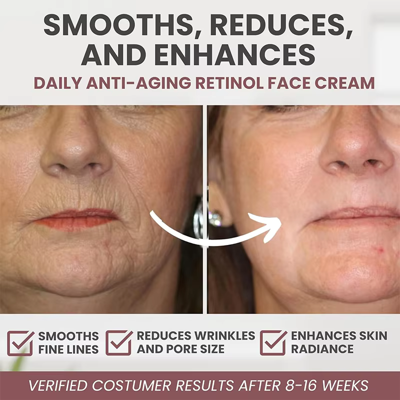AgeDefy™ Retinol Cream | + FREE HydraGlow™ Hyaluronic Acid & PureLift™ Collagen Cream Combo – Ultimate Skin Care Set