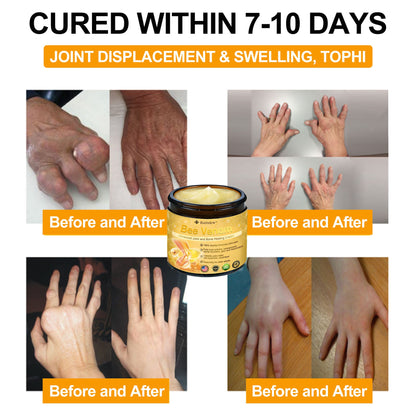 Benhjälte™ | Riktad lindring för värkande leder och ben