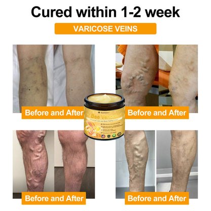 Benhjälte™ | Riktad lindring för värkande leder och ben