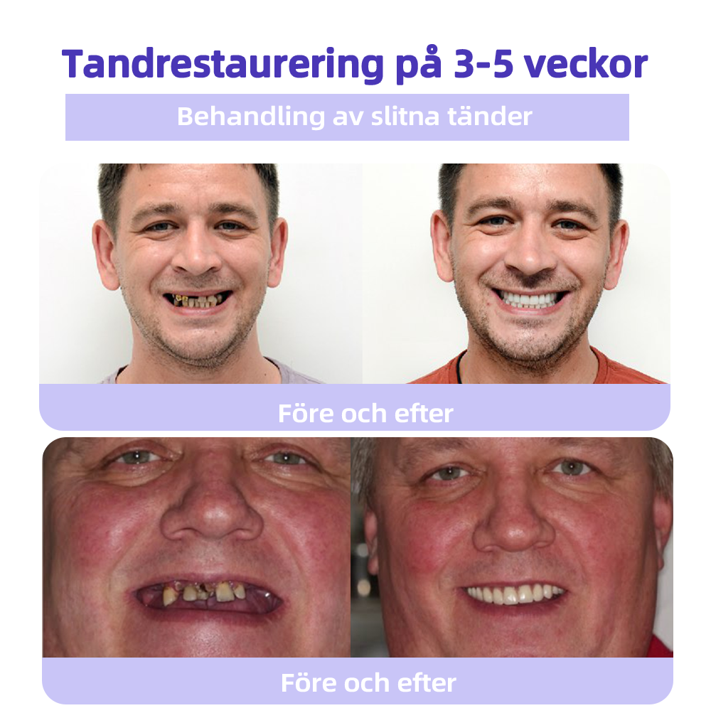 DentaShield™ | Skydda & Stärk Dina Tänder
