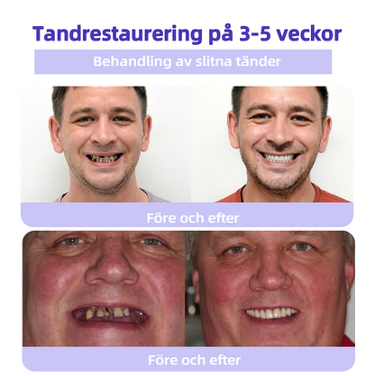 DentaShield™ | Skydda & Stärk Dina Tänder