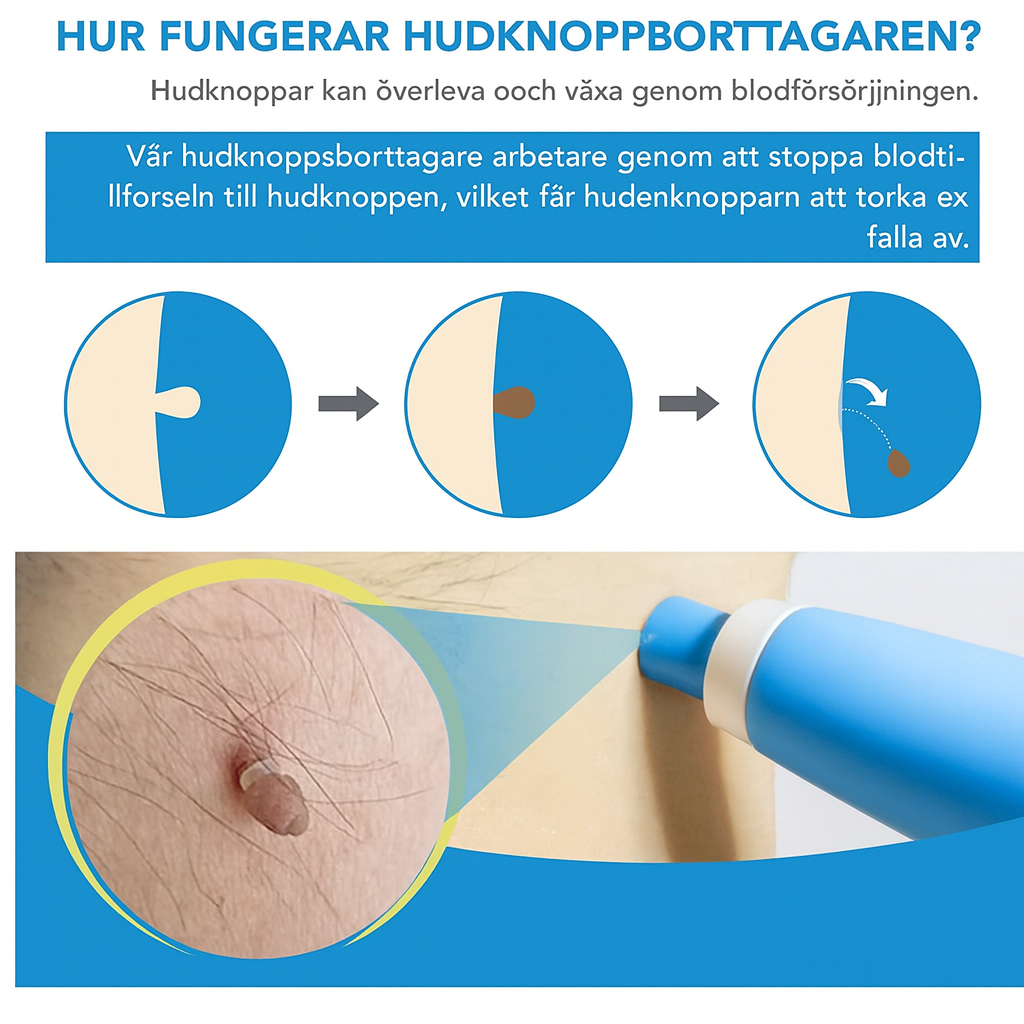 TagFree™ | Ta bort hudflikar enkelt – utan smärta, utan ärr, utan stress