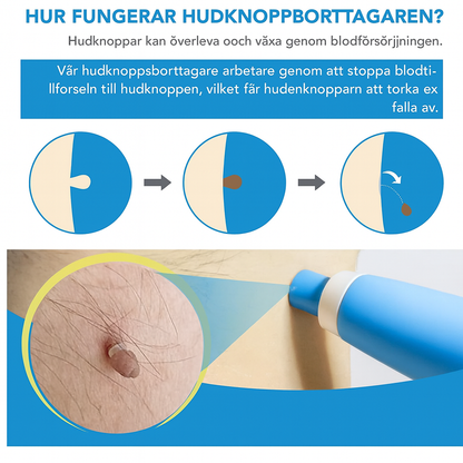 TagFree™ | Ta bort hudflikar enkelt – utan smärta, utan ärr, utan stress