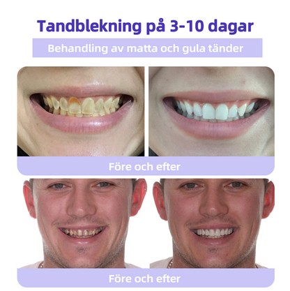 DentaShield™ | Skydda & Stärk Dina Tänder