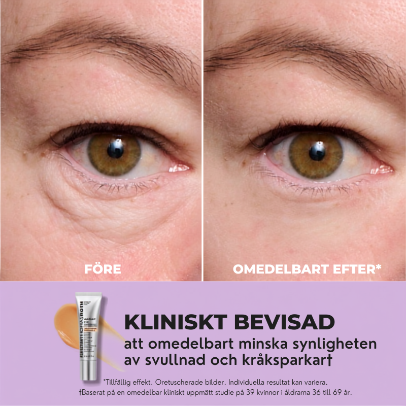 WrinkleRemover™ | Omedelbar ansiktsuppstramning primer utan filter