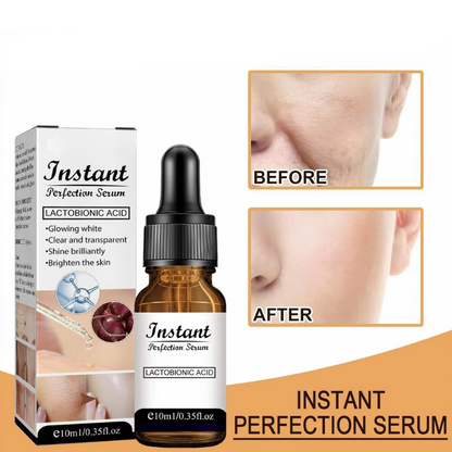 RenLyft™ | Släpper bort rynkor och ger lyster