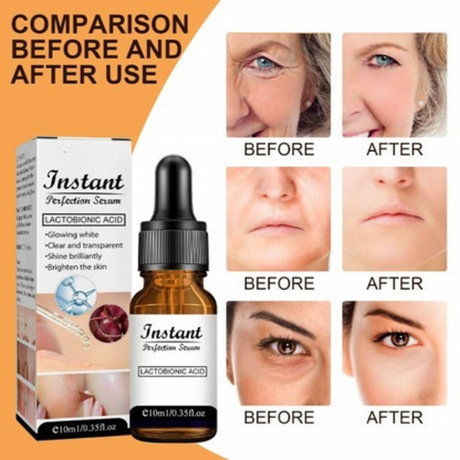 RenLyft™ | Släpper bort rynkor och ger lyster