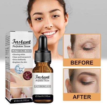 RenLyft™ | Släpper bort rynkor och ger lyster