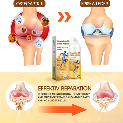 JointEase™ | Stoppa smärtan – återfå smidig och lätt rörelse på bara 48 timmar