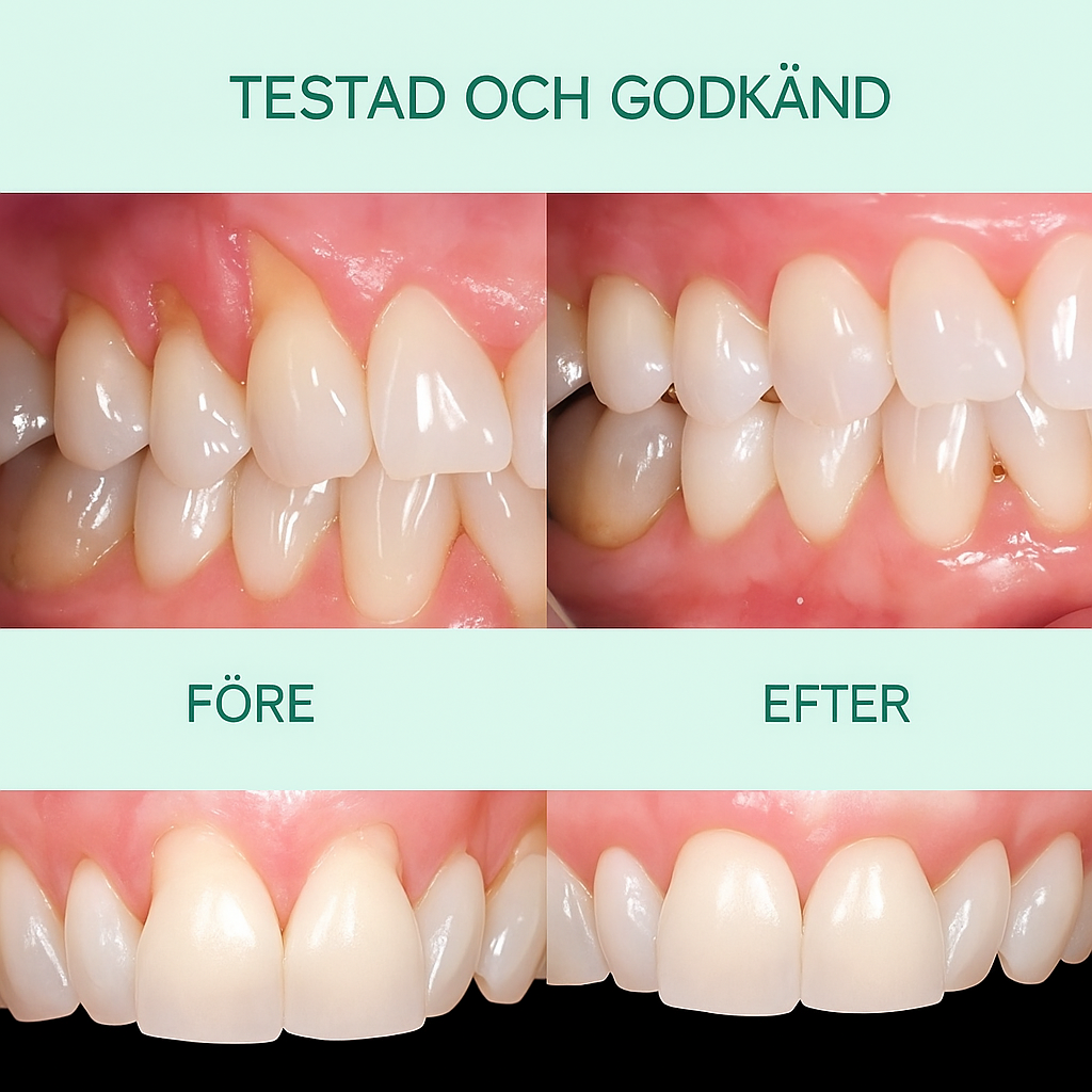 ReGum™ | Stoppa blödande, smärtsamt och svullet tandkött – återställ ditt friska leende