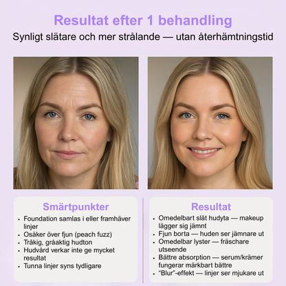 SilkRenew™ | Förnya din huds yta direkt – känn dig självsäker och ung igen