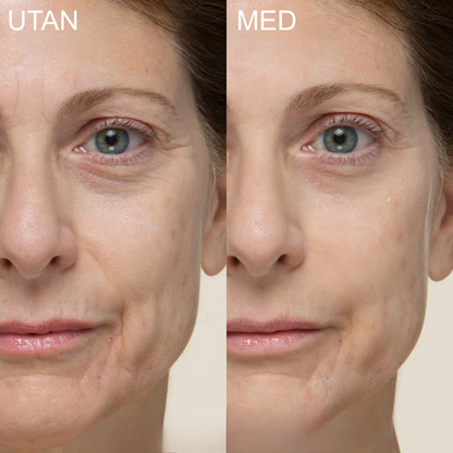 Liftora™ | Stramar omedelbart upp huden – raderar rynkor, svullnad och fina linjer