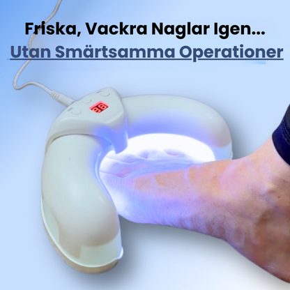 NailHeal™ | Ta bort envis nagelsvamp och återställ friska naglar