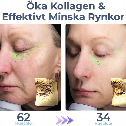 LumiEyes™ | Minska synligt rynkor och återställ fasthet runt ögonen
