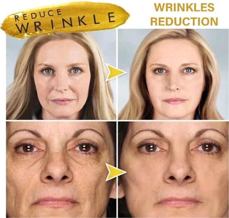 LuxPeel™ | Peelar bort orenheter och ger en ljusare hud