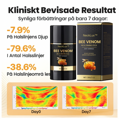 NeckLux™ | Stärk och strama upp den känsliga halshuden direkt