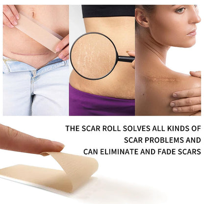 Ärrbort™ | Smidigt sätt att bleka ärr skonsamt och effektivt!