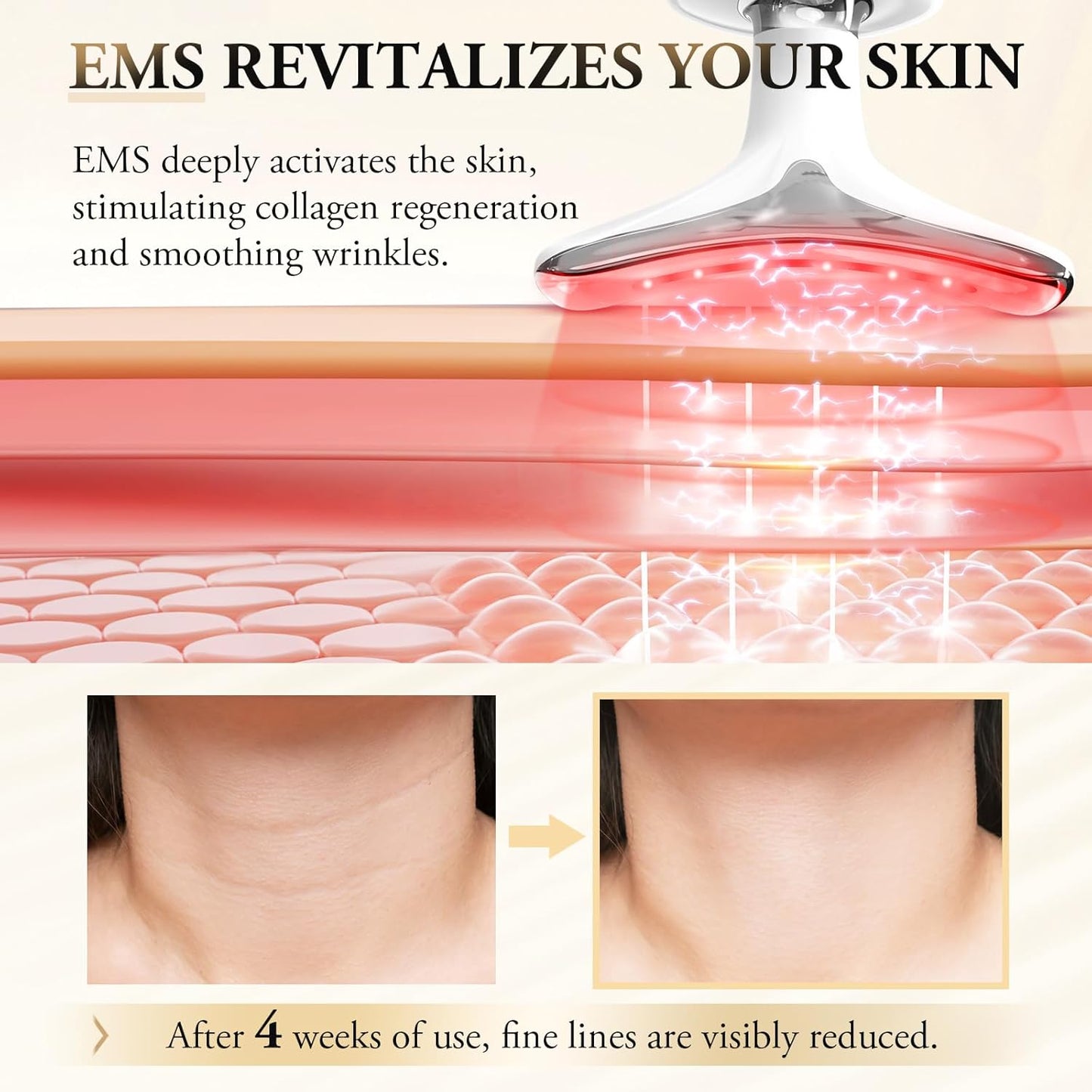 Dermalyft™ | Lyft, strama upp och jämna ut din hud - inga nålar behövs!