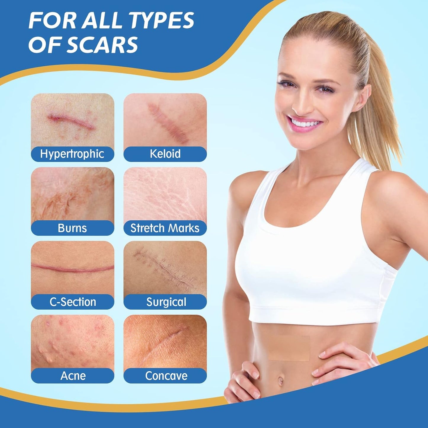 Ärrbort™ | Smidigt sätt att bleka ärr skonsamt och effektivt!