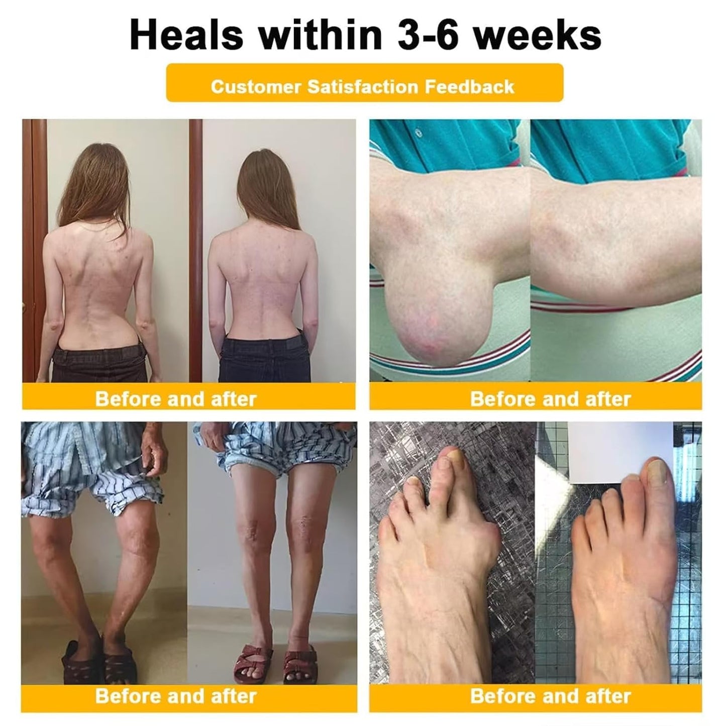 JointCure™ | Djupt penetrerande kräm mot artrit och ledsmärta