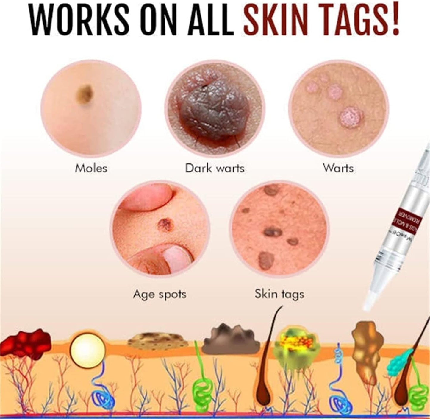 DermaLux™ | Eliminera vårtor och fläckar smärtfritt på bara 3 dagar