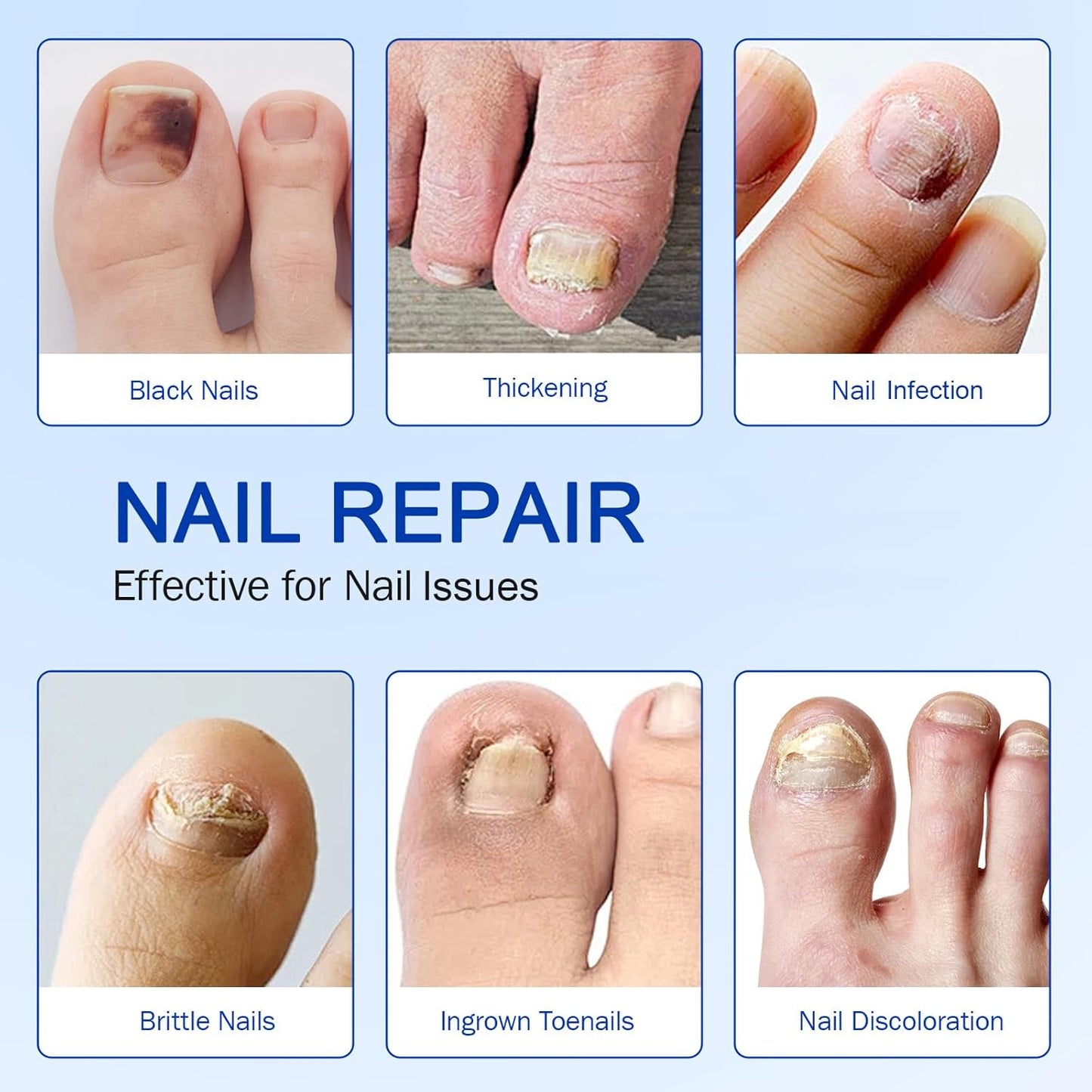 ClearNail™ | Säg hejdå till nagelsvamp — återfå en hälsosam glans