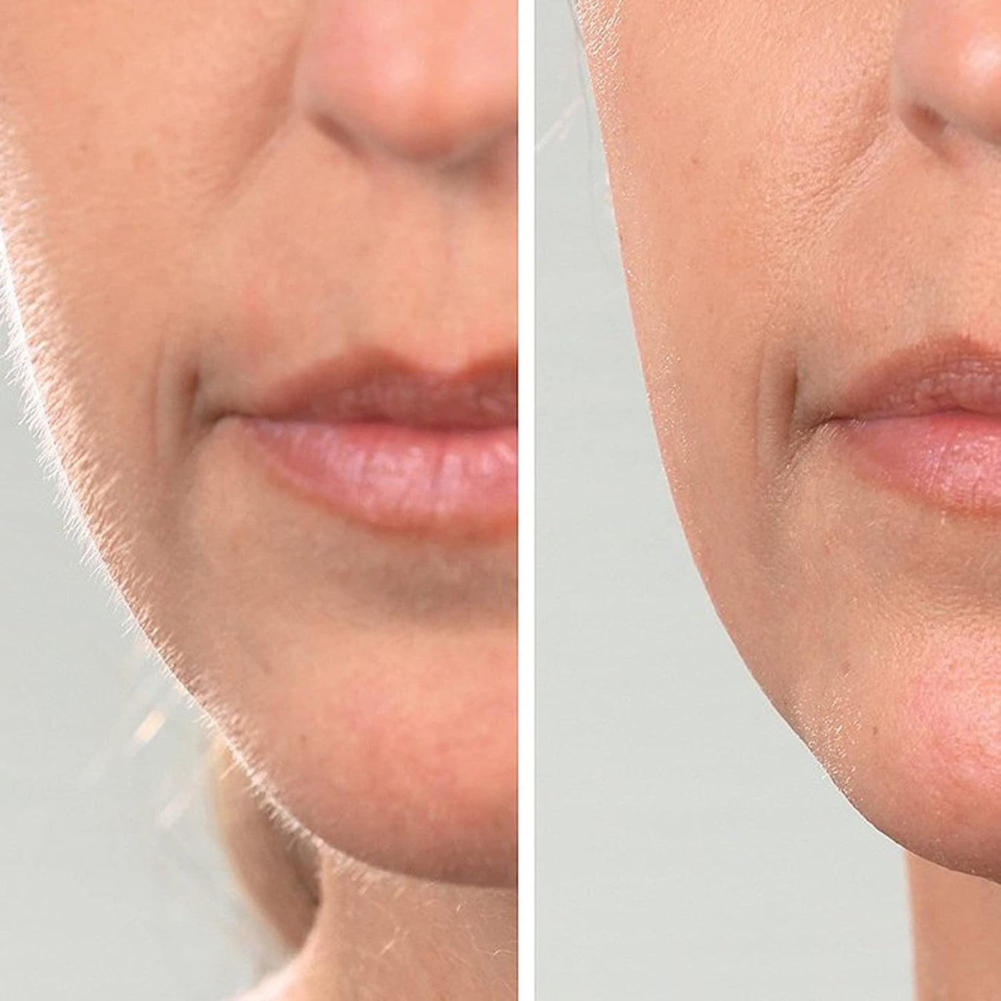 SilkRenew™ | Förnya din huds yta direkt – känn dig självsäker och ung igen