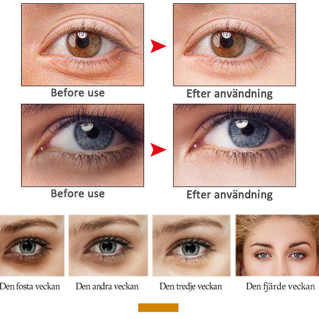 Liftora™ | Stramar omedelbart upp huden – raderar rynkor, svullnad och fina linjer