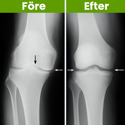 WalkReviver™ | Stoppa stelhet i knäna och rör dig fritt utan smärta