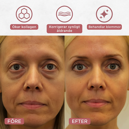 LumiThera™ | Ljusna, strama upp och väck dina trötta ögon – visa förnyad självsäkerhet