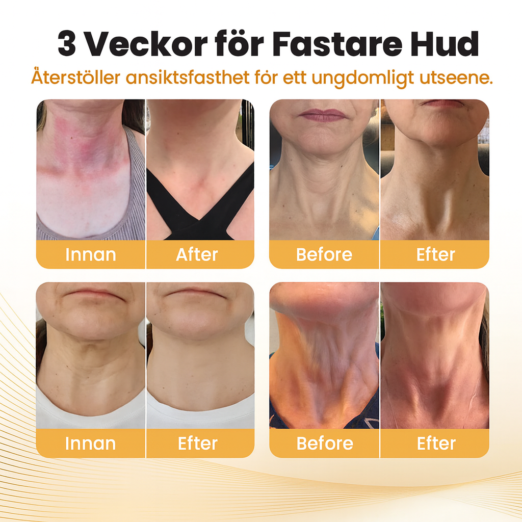 NeckLux™ | Stärk och strama upp den känsliga halshuden direkt