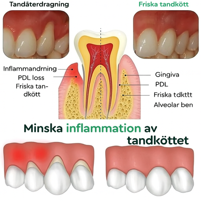 GumHeal™ | Från blödande tandkött till förnyelse – synliga resultat på 4 dagar