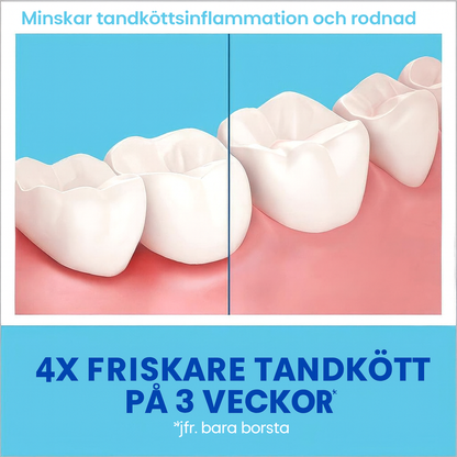 OralWhite™ | Ta bort tandsten, lugna tandköttet – vitare tänder, fräschare andedräkt