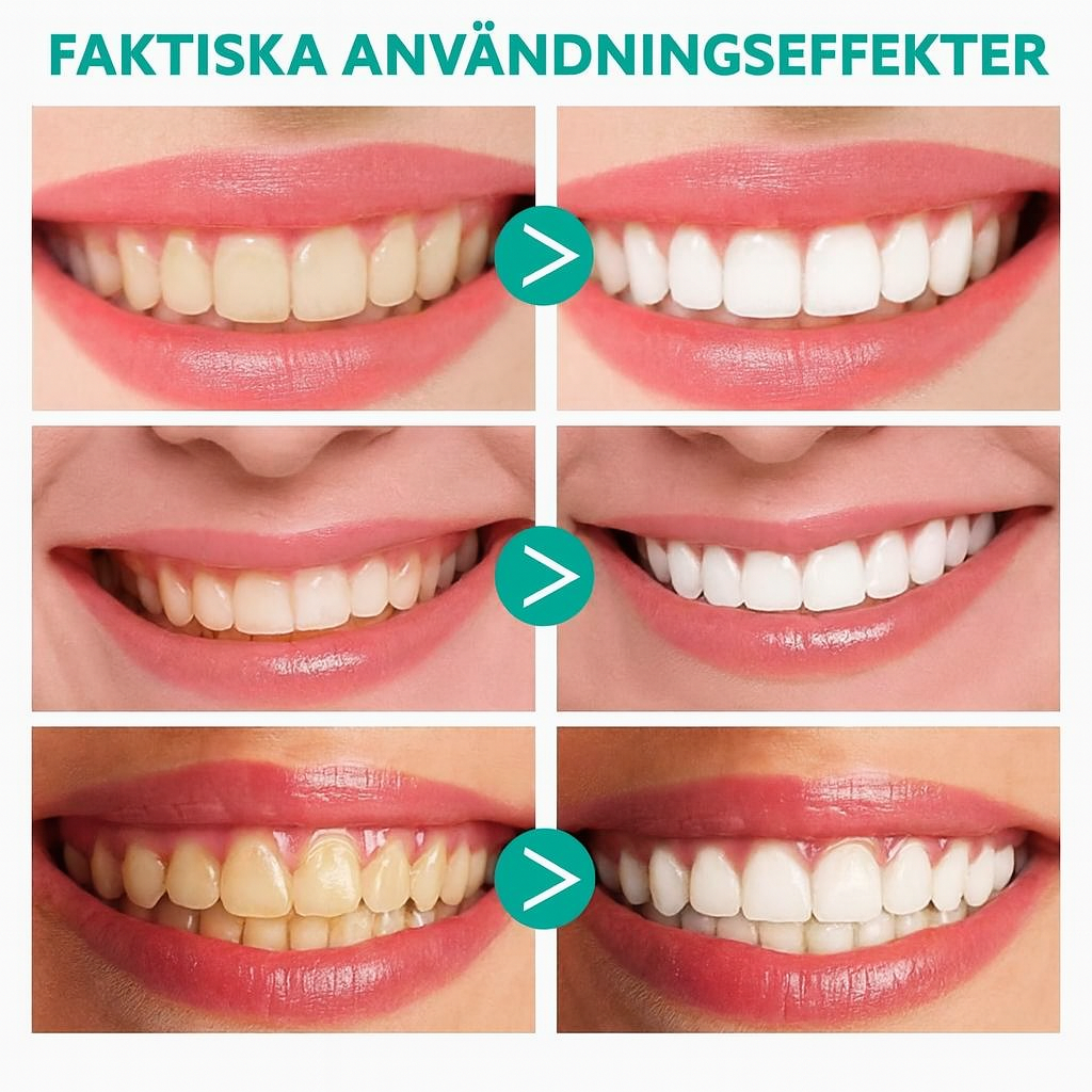 OralWhite™ | Ta bort tandsten, lugna tandköttet – vitare tänder, fräschare andedräkt