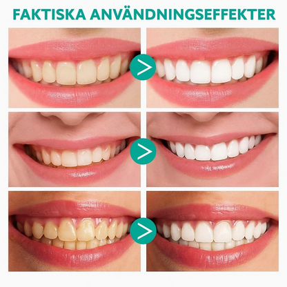 OralWhite™ | Ta bort tandsten, lugna tandköttet – vitare tänder, fräschare andedräkt