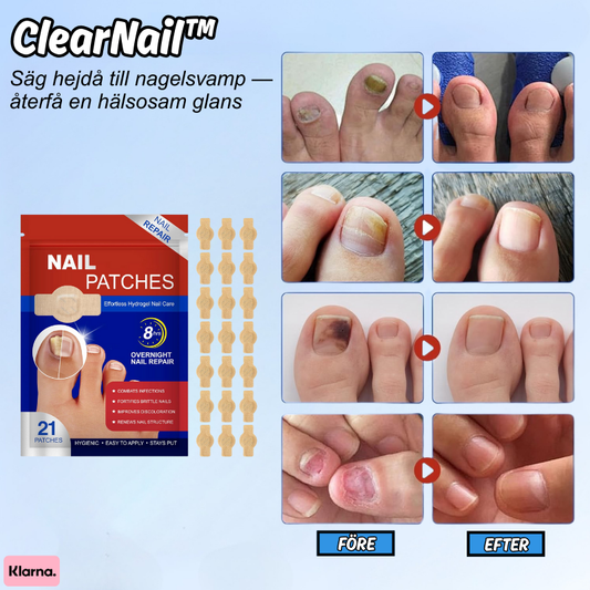 ClearNail™ | Säg hejdå till nagelsvamp — återfå en hälsosam glans