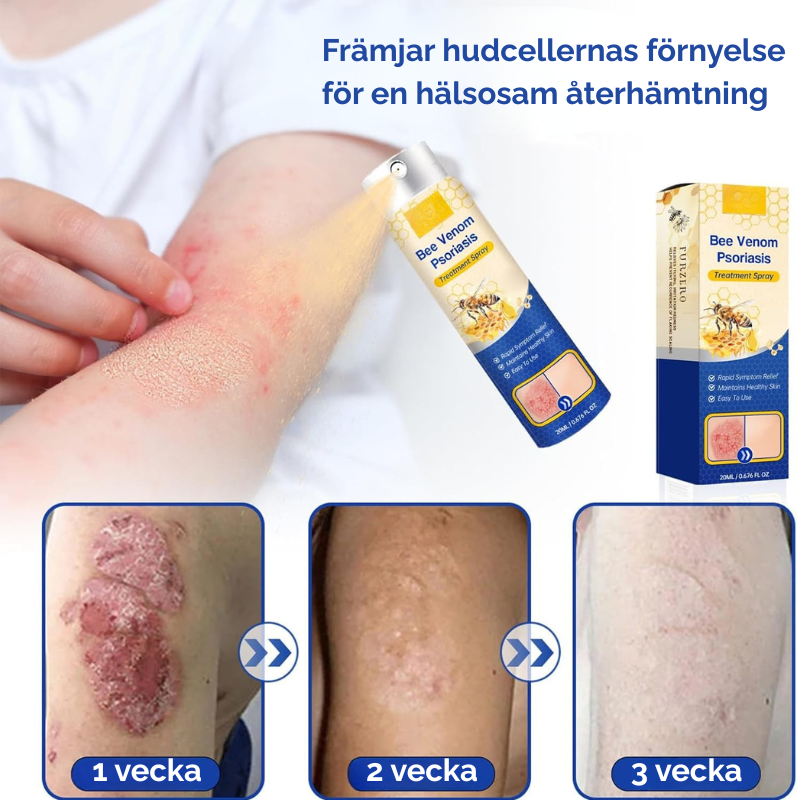 DermaEase™ | Omedelbar lindring av envis psoriasis