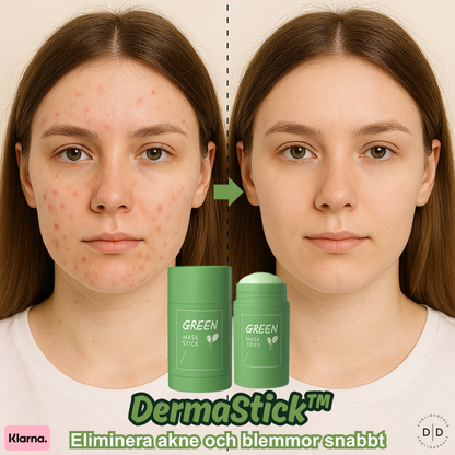 DermaStick™ | Eliminera akne och blemmor snabbt – återfå ditt självförtroende eller din skönhet