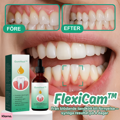 GumHeal™ | Från blödande tandkött till förnyelse – synliga resultat på 4 dagar