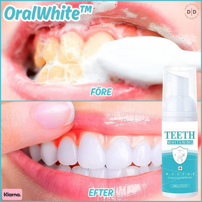 OralWhite™ | Ta bort tandsten, lugna tandköttet – vitare tänder, fräschare andedräkt