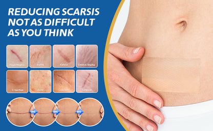 Ärrbort™ | Smidigt sätt att bleka ärr skonsamt och effektivt!