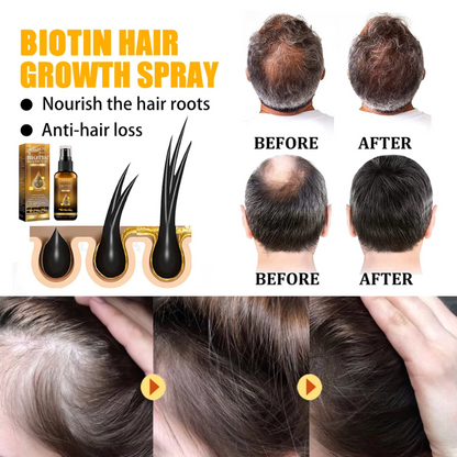 BioGrow Plus™ | Biotin Premium Hair Booster
