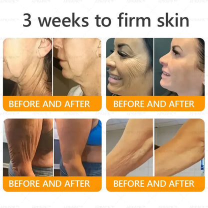 Venoméa™ | Säg adjö till slapp hud, rynkor och fina linjer på bara 7 dagar