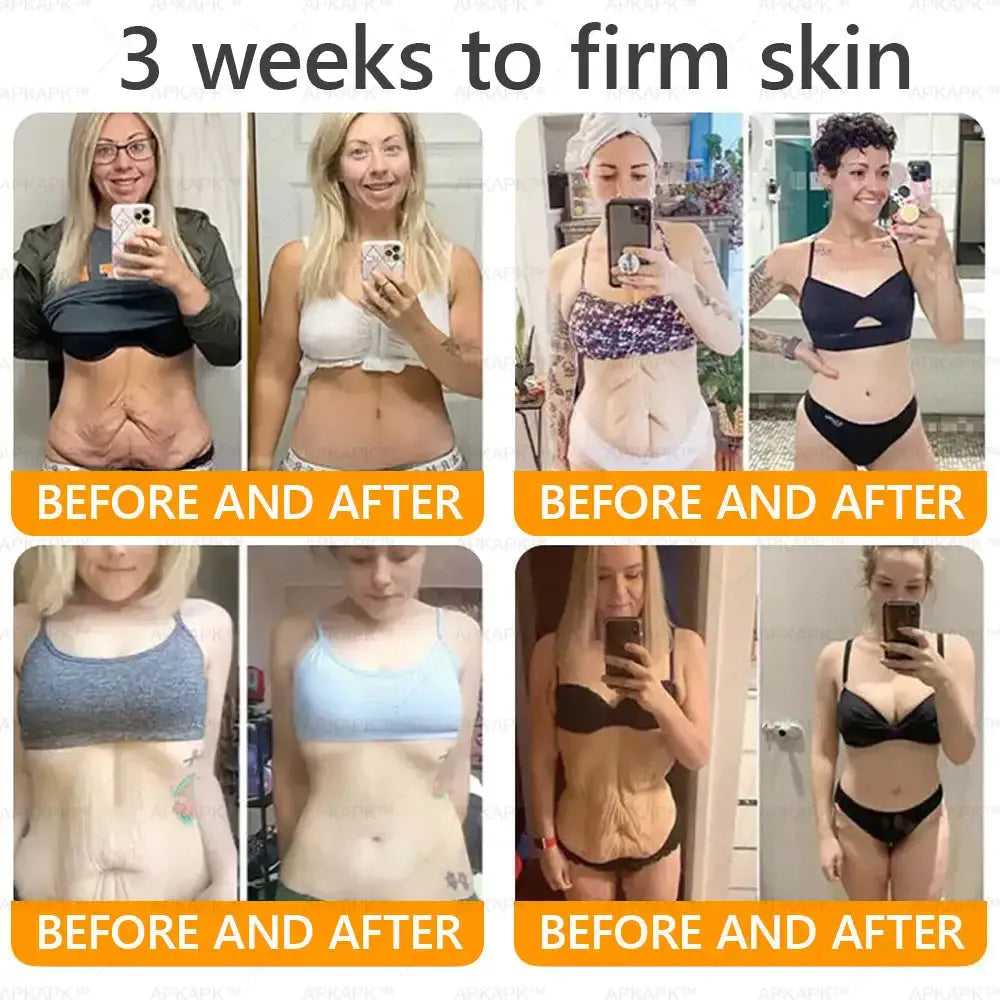 Venoméa™ | Säg adjö till slapp hud, rynkor och fina linjer på bara 7 dagar