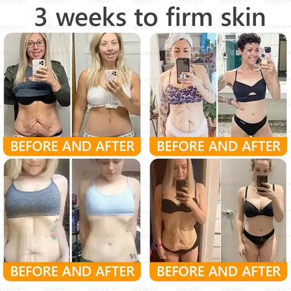 Venoméa™ | Säg adjö till slapp hud, rynkor och fina linjer på bara 7 dagar