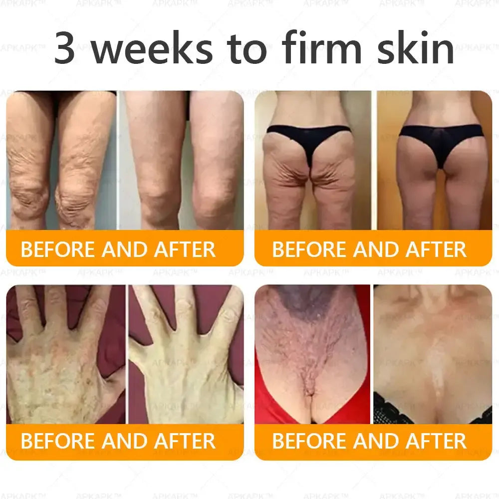 Venoméa™ | Säg adjö till slapp hud, rynkor och fina linjer på bara 7 dagar